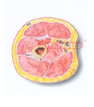 HUMAN TRANSVERSE SECTION MODEL THROUGH THE MIDDLE 1/3 OF THE RIGHT ARM (B)HUMAN TRANSVERSE SECTION MODEL THROUGH THE MIDDLE 1/3 OF THE RIGHT ARM (B)